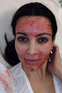 non surgical treatments for the eyes
